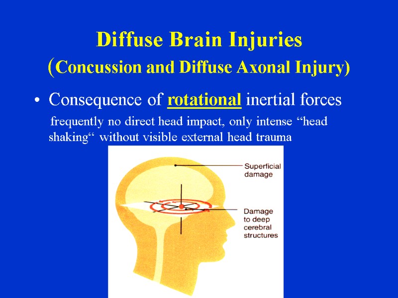 Diffuse Brain Injuries (Concussion and Diffuse Axonal Injury) Consequence of rotational inertial forces 